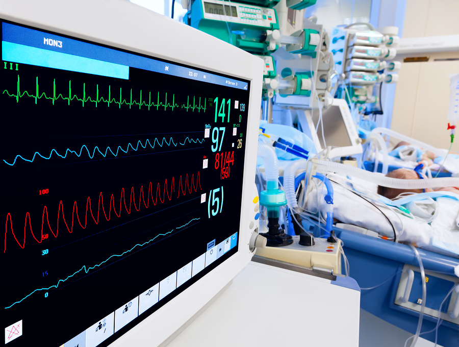 Pediatric ICU with ECG monitor on foreground